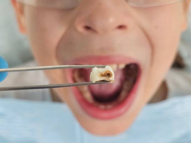 Professional Emergency Dental Service in NY