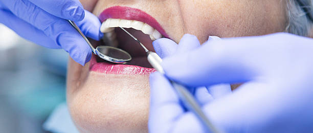 Best Broken or Chipped Tooth Repair in Mount Kisco, NY